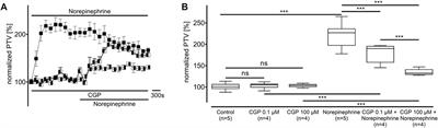 Dopamine, norepinephrine, and vasopressin accelerate particle transport velocity in murine tracheal epithelium via substance-specific receptor pathways: dependency on intra- and extracellular Ca2+ sources